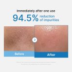 Zero Pore Blackhead Deep Cleansing Oil - Image 2