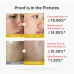 Kojic Acid Turmeric Peel Shot - Image 3