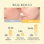 Kojic Acid Turmeric Gold Jelly Gel Mask - Image 3