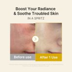 Kojic Acid Turmeric Vitamin Gold Jelly Mist Serum - Image 4