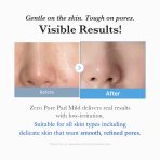 Zero Pore Madecassoside Pads (Mild) - Image 5