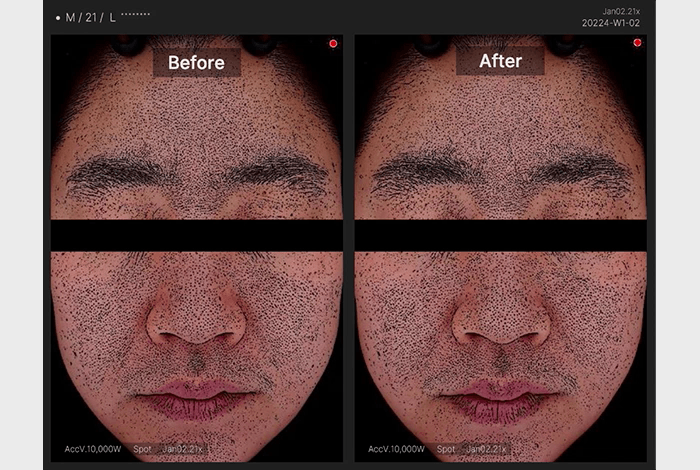 zero pads image
