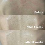 Red Body Wash - Image 8