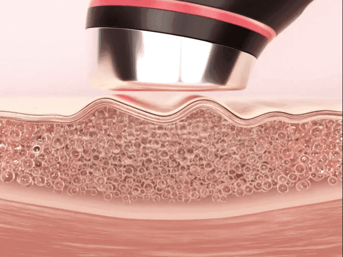 Derma mode