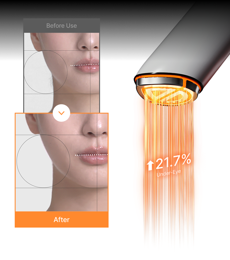 2X Skin-Defining clinical results