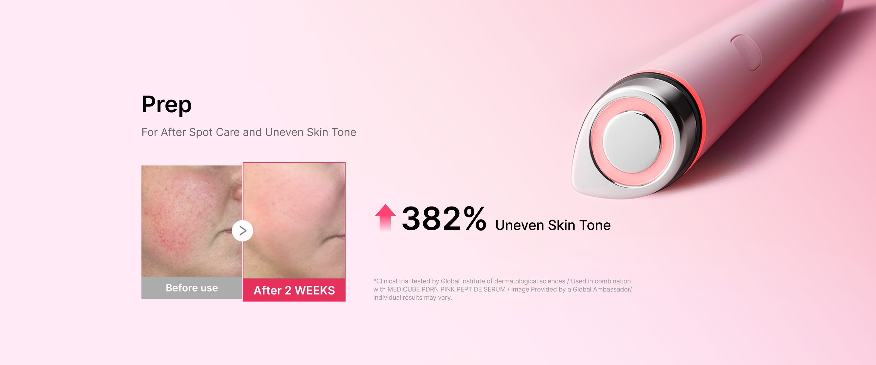 For After Spot Care and Uneven Skin Tone