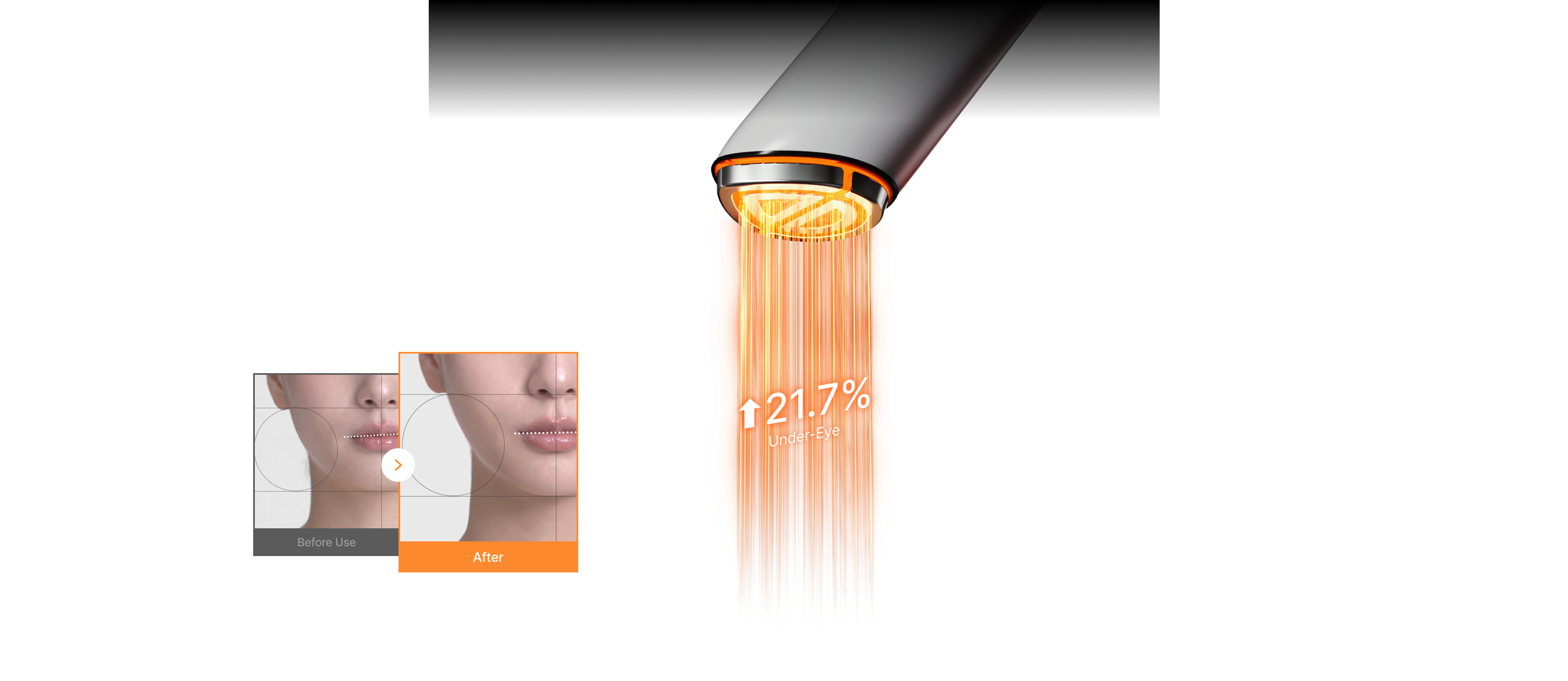 2X Skin-Defining clinical results